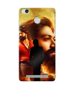 Rocky Bhai Walk Redmi 3S Prime Real 4D Back Cover