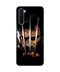 Wolverine Poster Oneplus Nord Back Cover