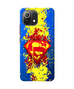 Superman logo Mi 11 Lite Back Cover