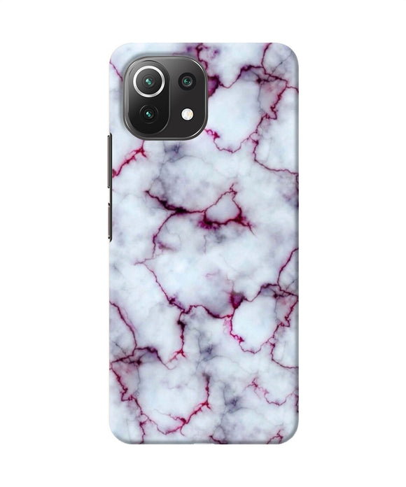 Brownish marble Mi 11 Lite Back Cover