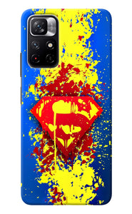 Superman logo Redmi Note 11T 5G Back Cover