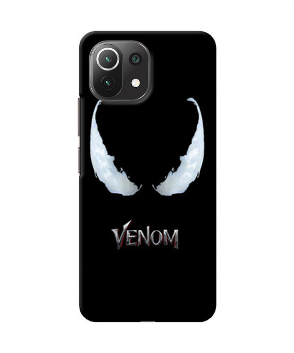 Venom poster Mi 11 Lite NE 5G Back Cover