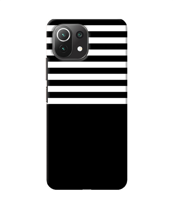 Black and white print Mi 11 Lite NE 5G Back Cover