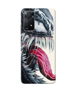 Angry venom Redmi Note 11 Pro Back Cover