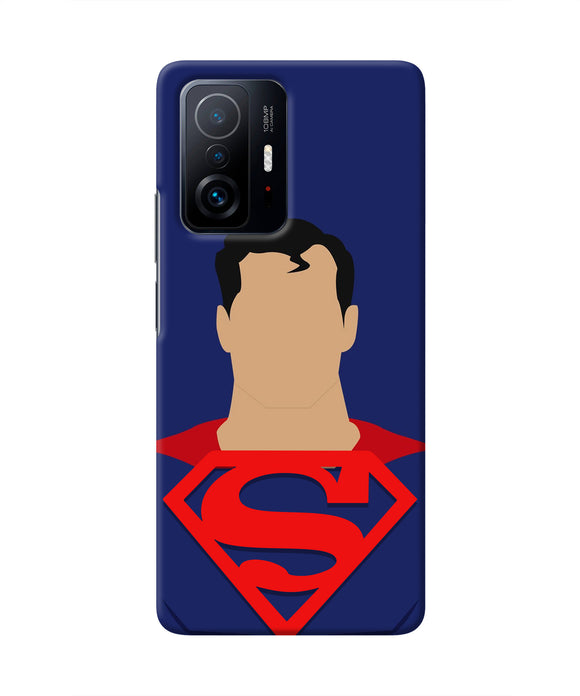 Superman Cape Mi 11T Pro 5G Real 4D Back Cover