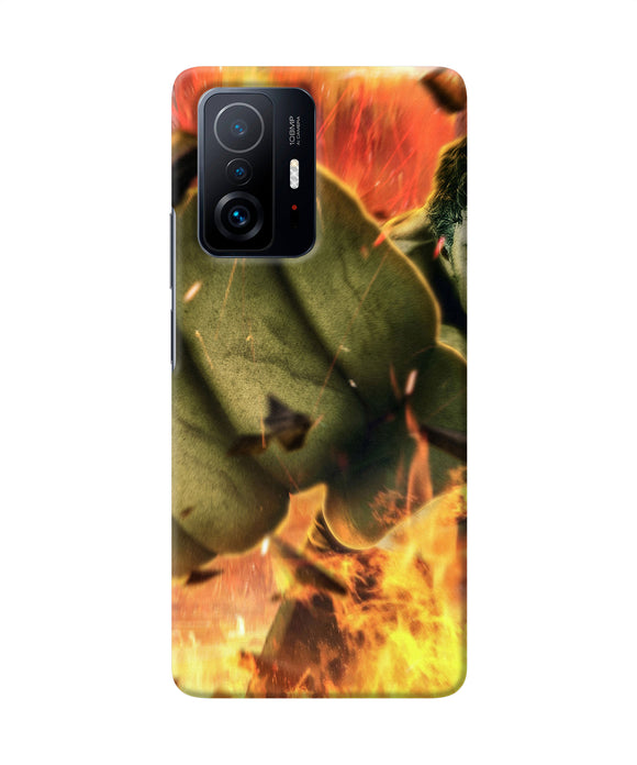 Hulk smash Mi 11T Pro 5G Back Cover