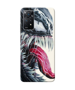 Angry venom Redmi Note 11 Pro Plus 5G Back Cover