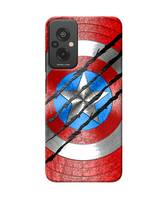 Scratch on shield Redmi 11 Prime 5G Back Cover